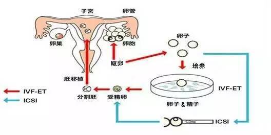 泰国试管婴儿费用